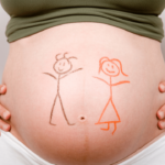 Sexagem Fetal